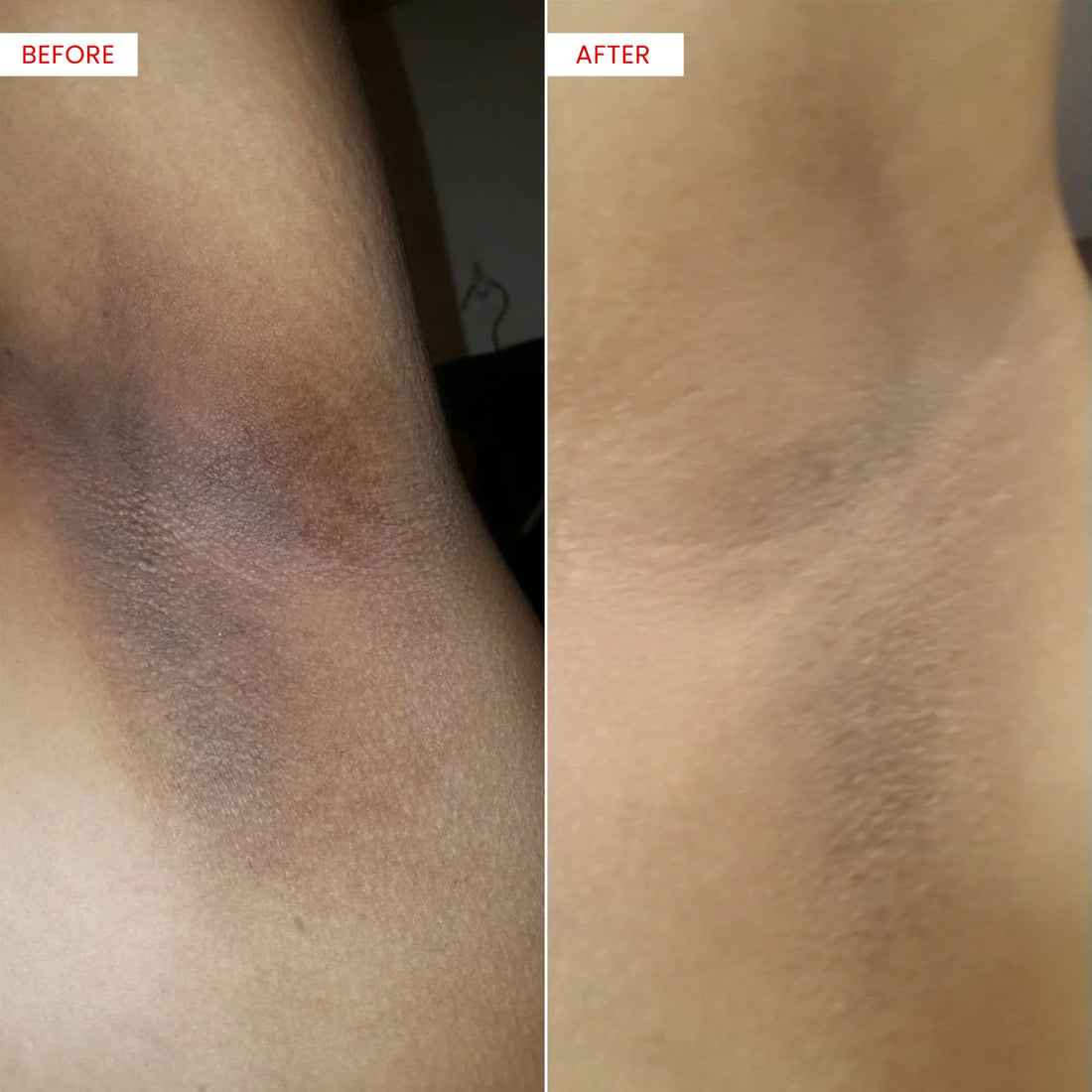 Koji White- Bright Booster Underarm Serum