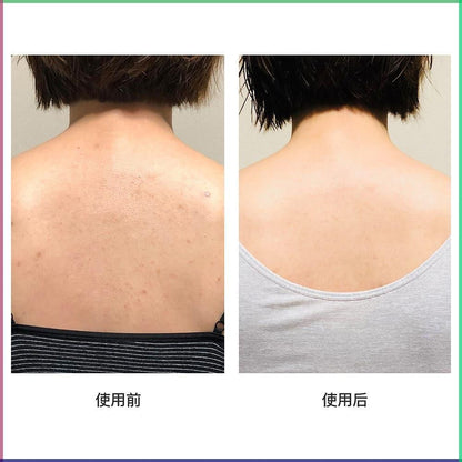 Deitanseki for Back acne 50g
