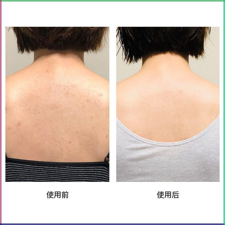 Deitanseki for Back acne 50g