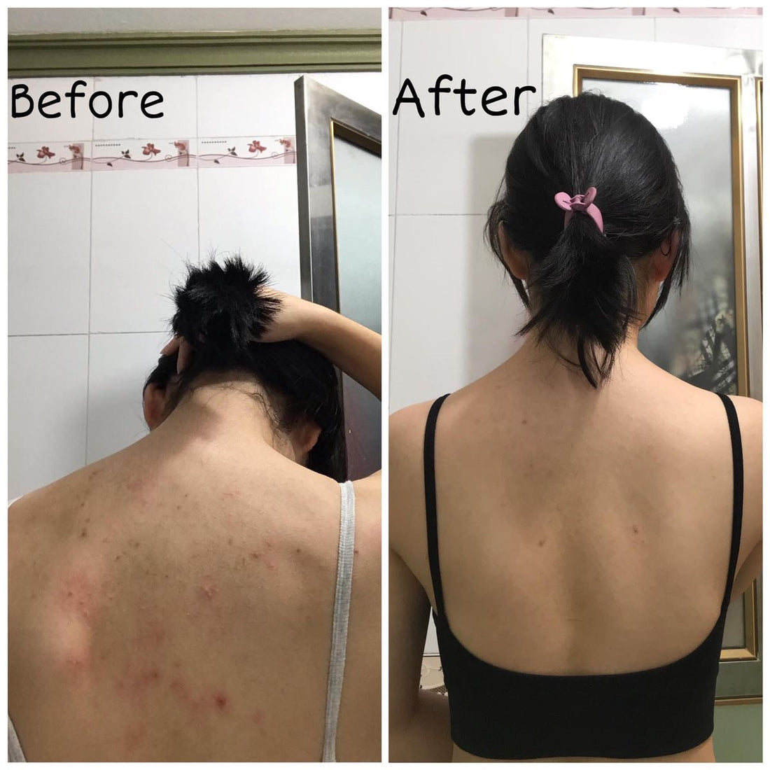 Deitanseki for Back acne 50g