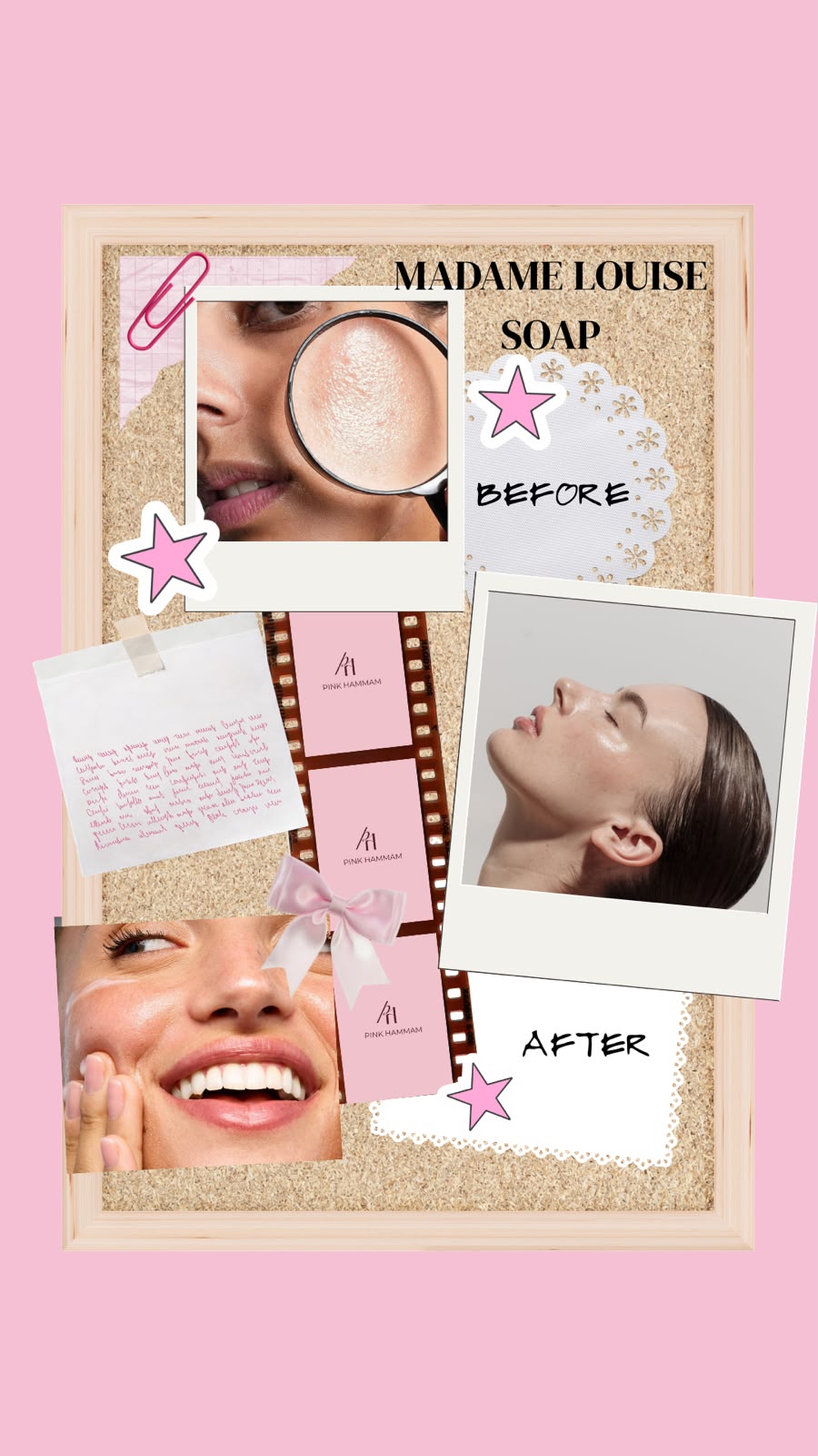 Madame Louise Soap – Blemish free skin