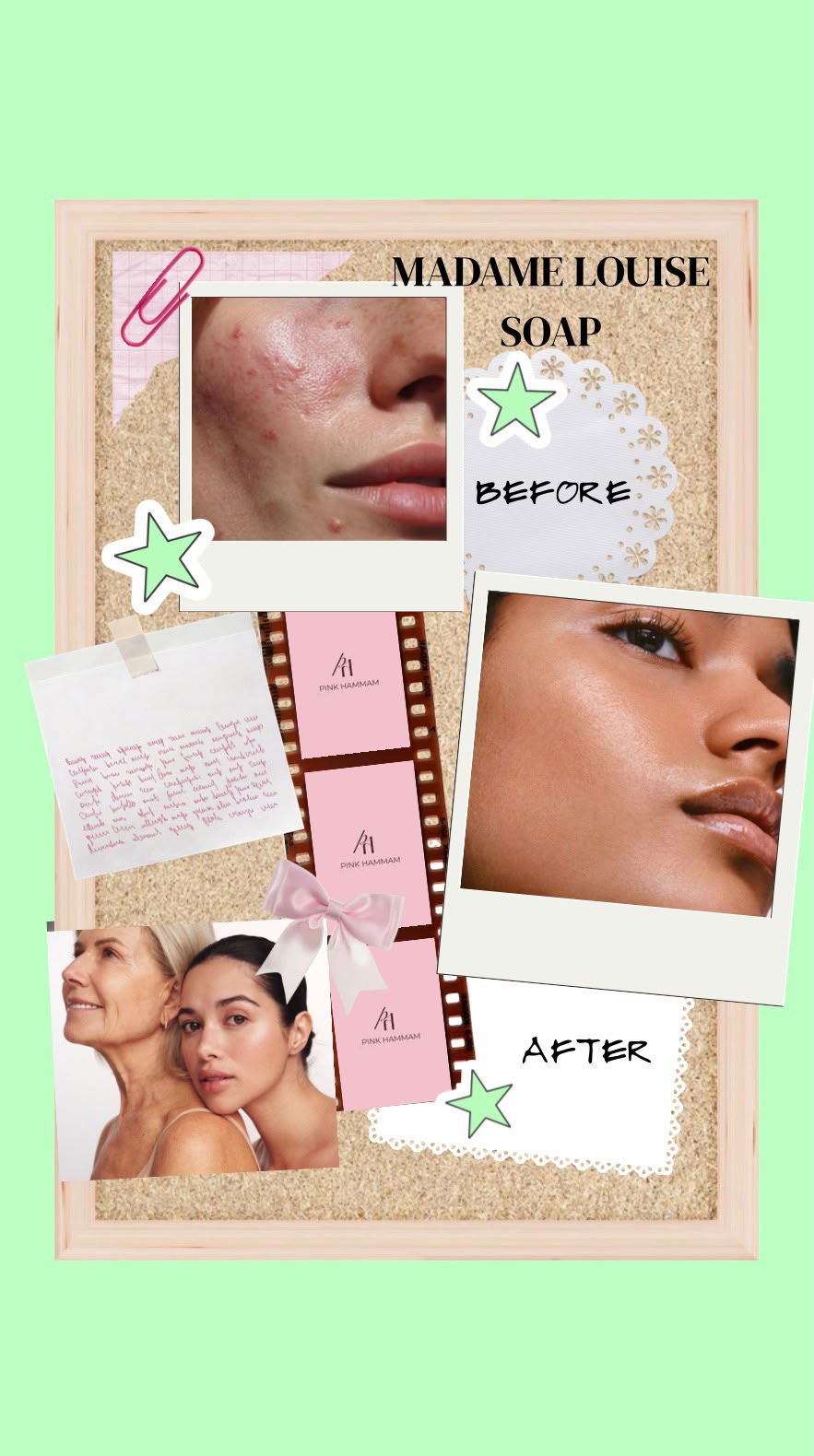 Madame Louise Soap Clear Defense Acne.