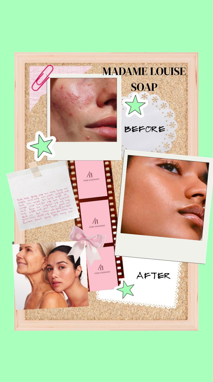 Madame Louise Soap Clear Defense Acne.
